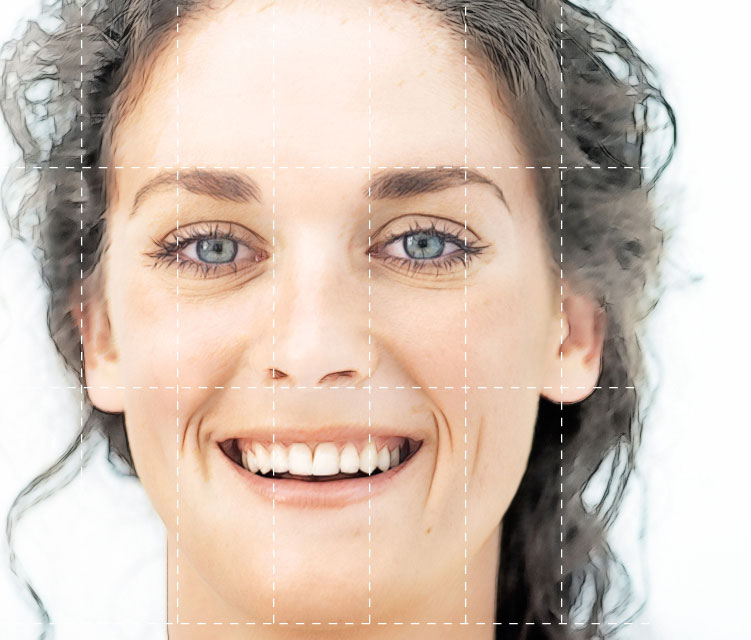 Facial asymmetry diagram