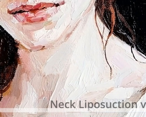 Neck Liposuction vs. Lift