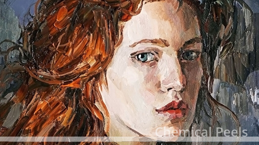 Chemical Peels redhead art