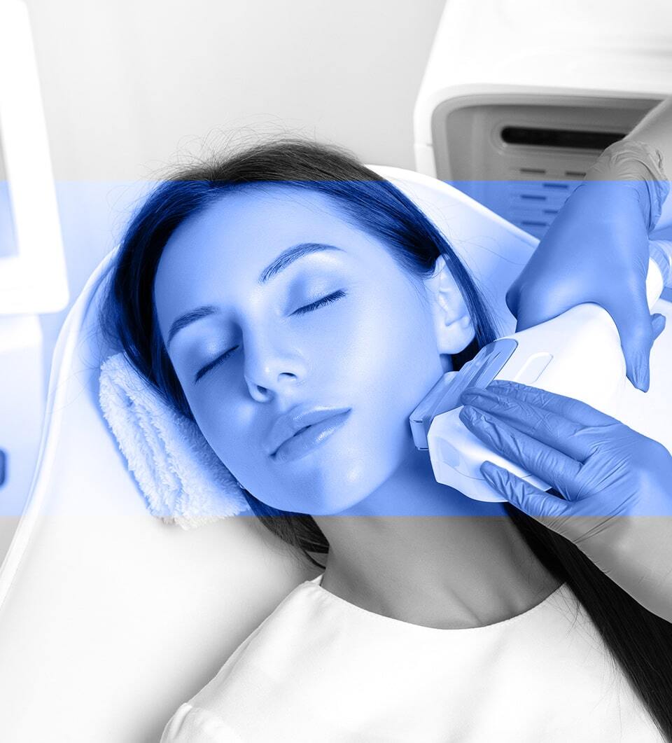 IPL treatment in Toronto