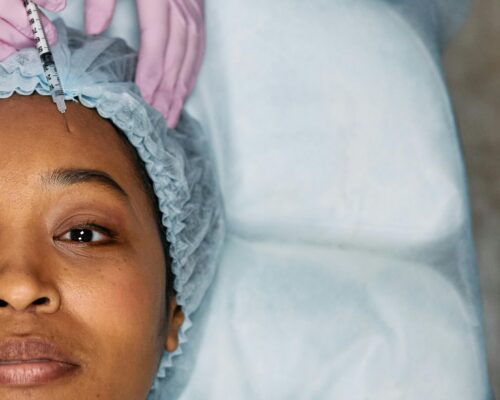facelift longevity