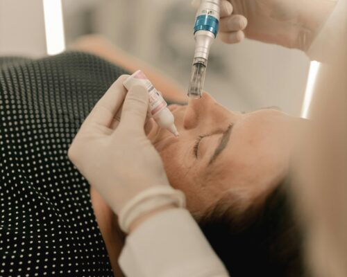 microneedling benefits